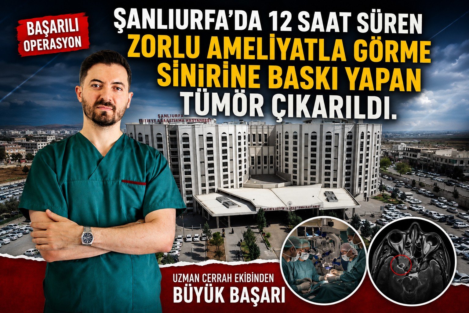 Şanlıurfa'da 12 Saat Süren Zorlu Ameliyatla Görme Sinirine Baskı Yapan Tümör Çıkarıldı.